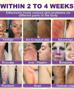 QIAWI® Proprietary Biotin Blend Skin Restoration Cream