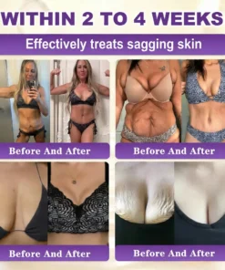 QIAWI® Proprietary Biotin Blend Skin Restoration Cream