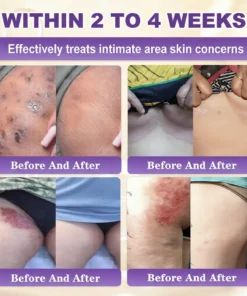 QIAWI® Proprietary Biotin Blend Skin Restoration Cream