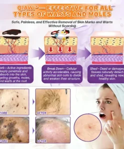 QIAWI® Proprietary Biotin Blend Skin Restoration Cream