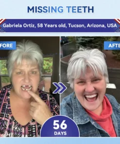 QIAWI® Tideglusib Fast‑Dissolving Tooth & Gum Repair Oral Strips