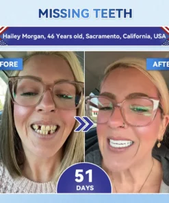 QIAWI® Tideglusib Fast‑Dissolving Tooth & Gum Repair Oral Strips