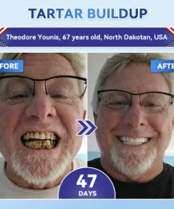 QIAWI® Tideglusib Fast‑Dissolving Tooth & Gum Repair Oral Strips