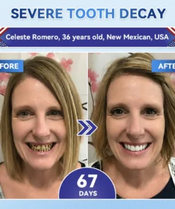 QIAWI® Tideglusib Fast‑Dissolving Tooth & Gum Repair Oral Strips