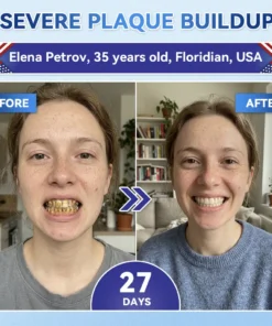 QIAWI® Tideglusib Fast‑Dissolving Tooth & Gum Repair Oral Strips