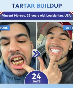 QIAWI® Tideglusib Fast‑Dissolving Tooth & Gum Repair Oral Strips