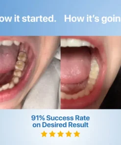 QIAWI Fluoride-Free Hydroxyapatite Tooth Armor Essence & Enamel Repair