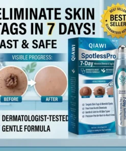 QIAWI® SpotlessPro Advanced Skin Care Pen
