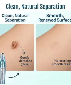 QIAWI® SpotlessPro Advanced Skin Care Pen