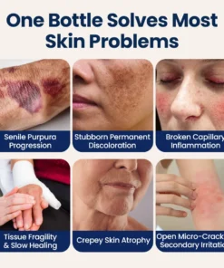 QIAWI® ResiliVeil Bruise Appearance Barrier Care Cream