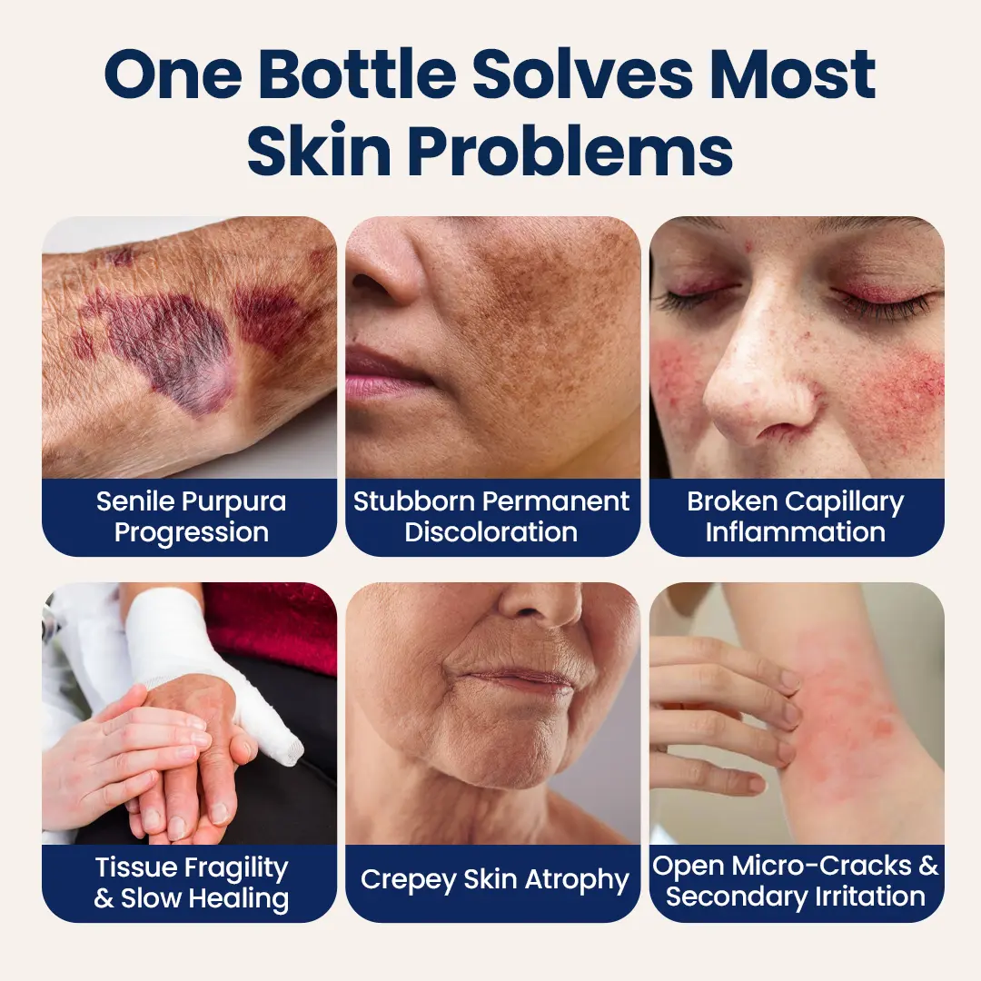 QIAWI® ResiliVeil Bruise Appearance Barrier Care Cream
